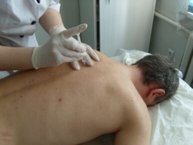 Intraartikuläre Injektionen von Chondroprotektoren bei thorakaler Osteochondrose.